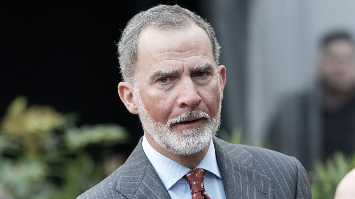 El rey Felipe VI reapareció con llamativas quemaduras en su cara El rey Felipe VI reapareció con llamativas quemaduras en su cara