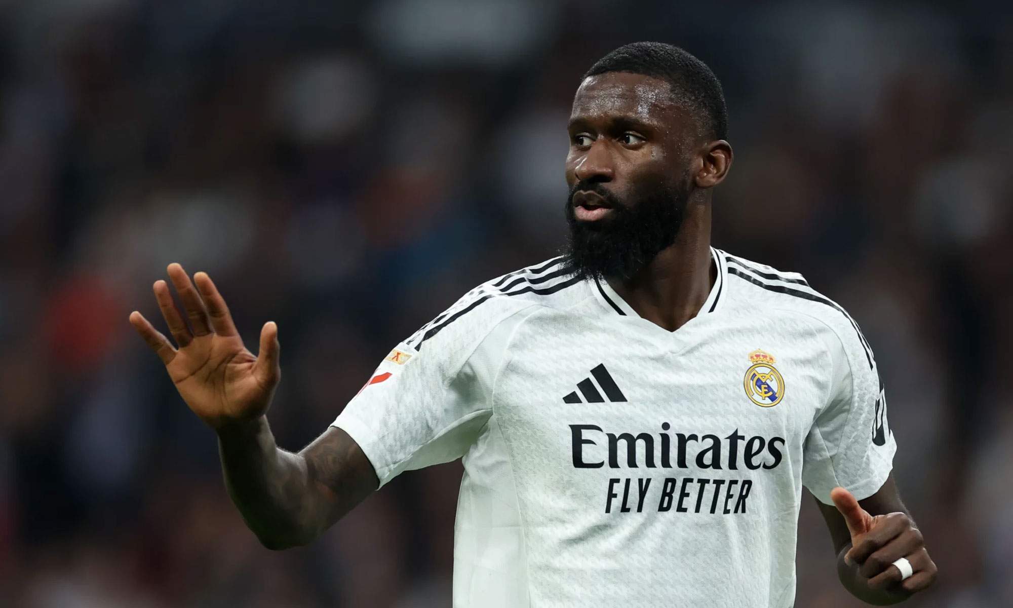 Oficial, Rudiger ha sido operado de la rodilla: el tiempo que será baja
