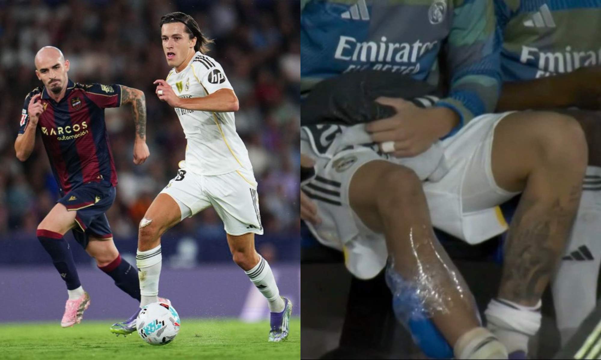 Álvaro Carreras terminó el encuentro con hielo en el banquillo