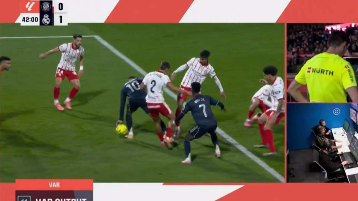 Mano de Kylian Mbappé
