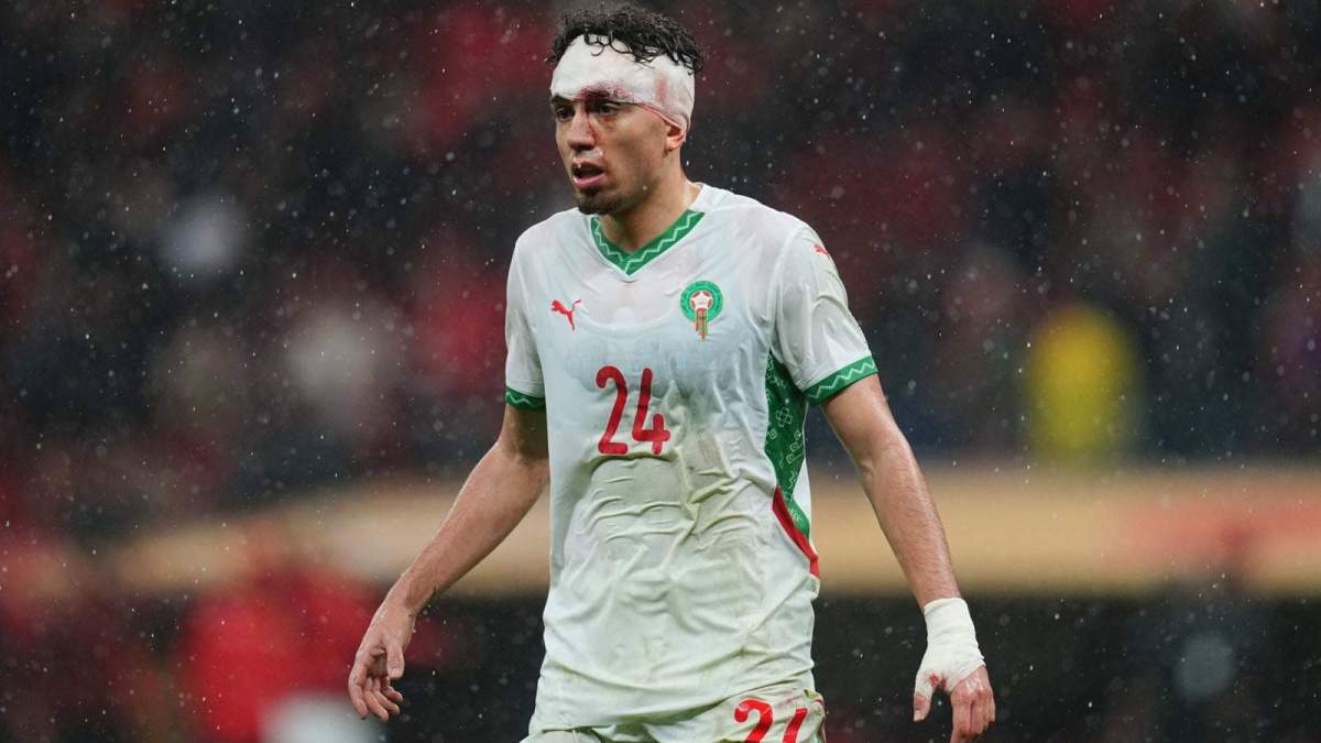 neil el aynaoui est revenu sur le terrain malgre une arcade sourcilliere ouverte lors de la finale de la can dimanche photo sipa 1768846106 neil el aynaoui est revenu sur le terrain malgre une arcade sourcilliere ouverte lors de la finale de la can dimanche photo sipa 1768846106