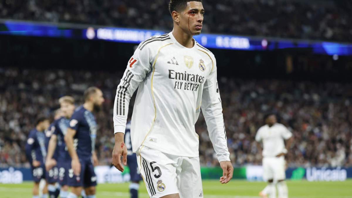 Bellingham, con la ceja rota tras el codazo de Borja Iglesias